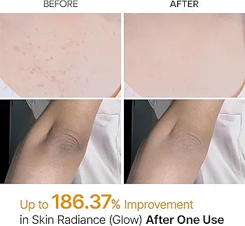 Dr.Melaxin Body Keratin Care Kojic Acid Turmeric Spray Gently Exfoliating Peeling Solution | 200ml
